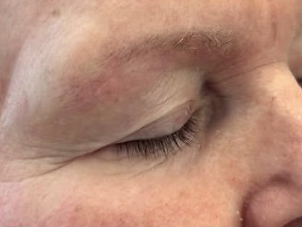 A client's brow before treatment — sparse and faded