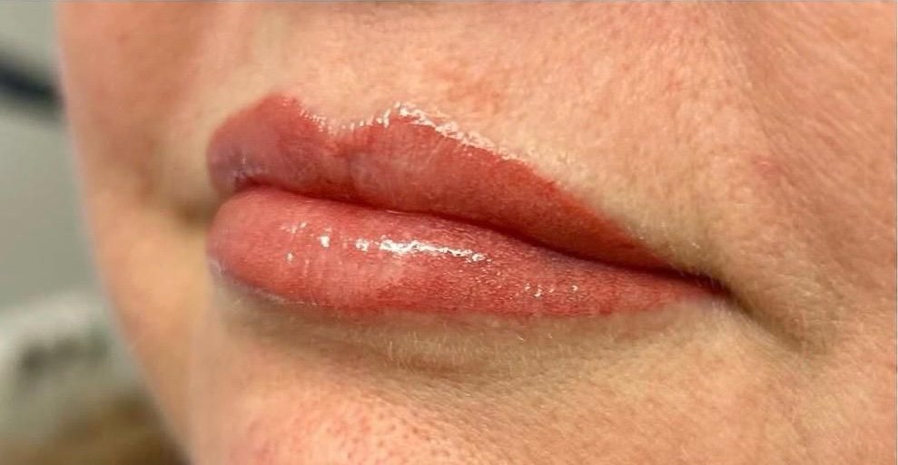 Lip blush by Alison Burns, straight after treatment