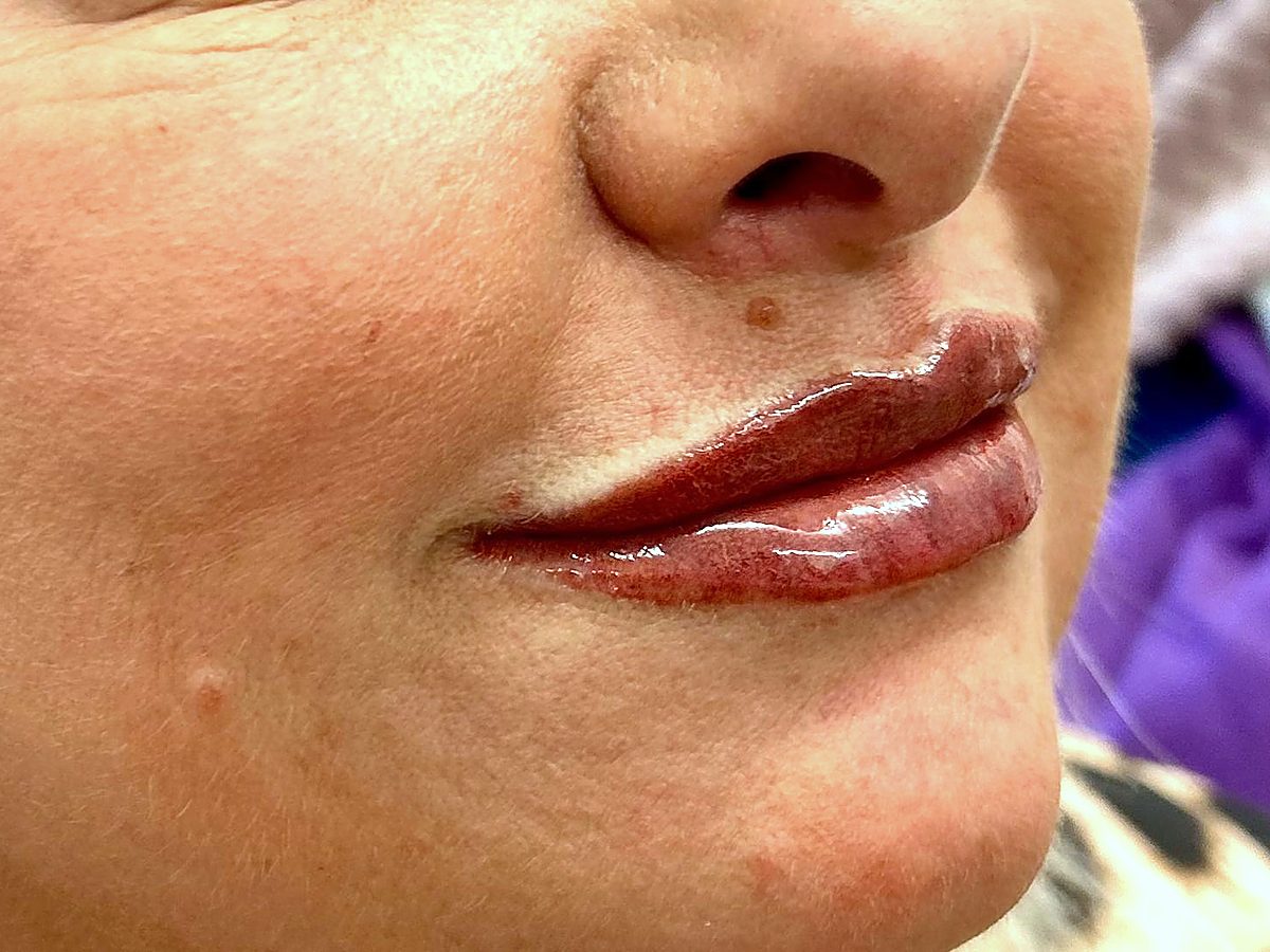 Lip blush by Alison Burns, straight after treatment